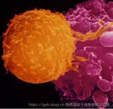 陕西自体干细胞移植全过程