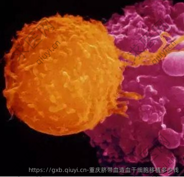 重庆脐带血造血干细胞移植多少钱
