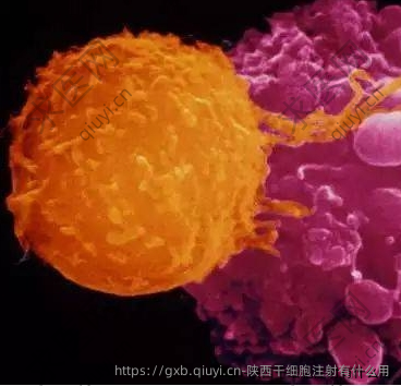 陕西干细胞注射有什么用