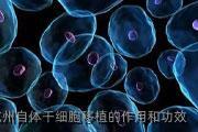 杭州自体干细胞移植的作用和功效