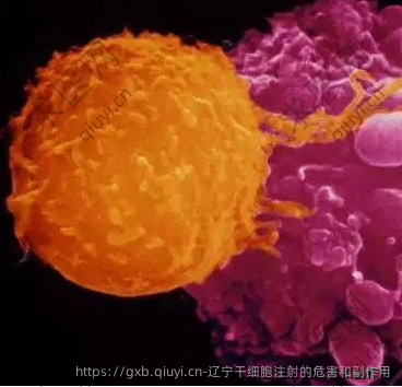 辽宁干细胞注射的危害和副作用