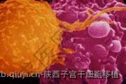 陕西子宫干细胞移植