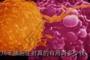 四川干细胞注射真的有用吗多少钱