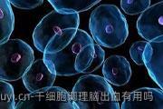 干细胞调理脑出血有用吗