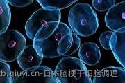 日本脑梗干细胞调理