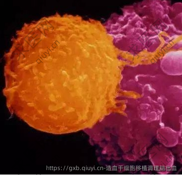 造血干细胞移植调理脑出血