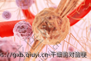 干细胞对脑梗