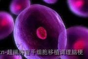 超细导管干细胞移植调理脑梗