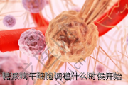 糖尿病干细胞调理什么时侯开始
